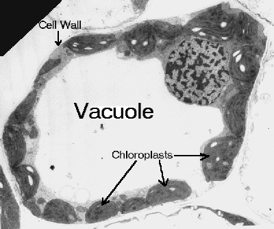 vacuoleem.jpg